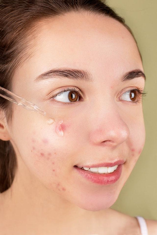 Unveiling the Transformative Power of Ozonated Oils for Various Skin Conditions - Naturally Wyld
